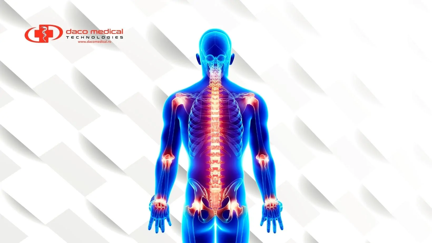 Nociceptol — Gelul Care Calmeaza Durerea fara Pastile