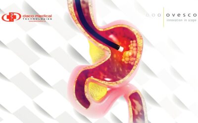 Ovesco® și hemostaza endoscopică: de la controlul hemoragiilor la prevenția complicațiilor
